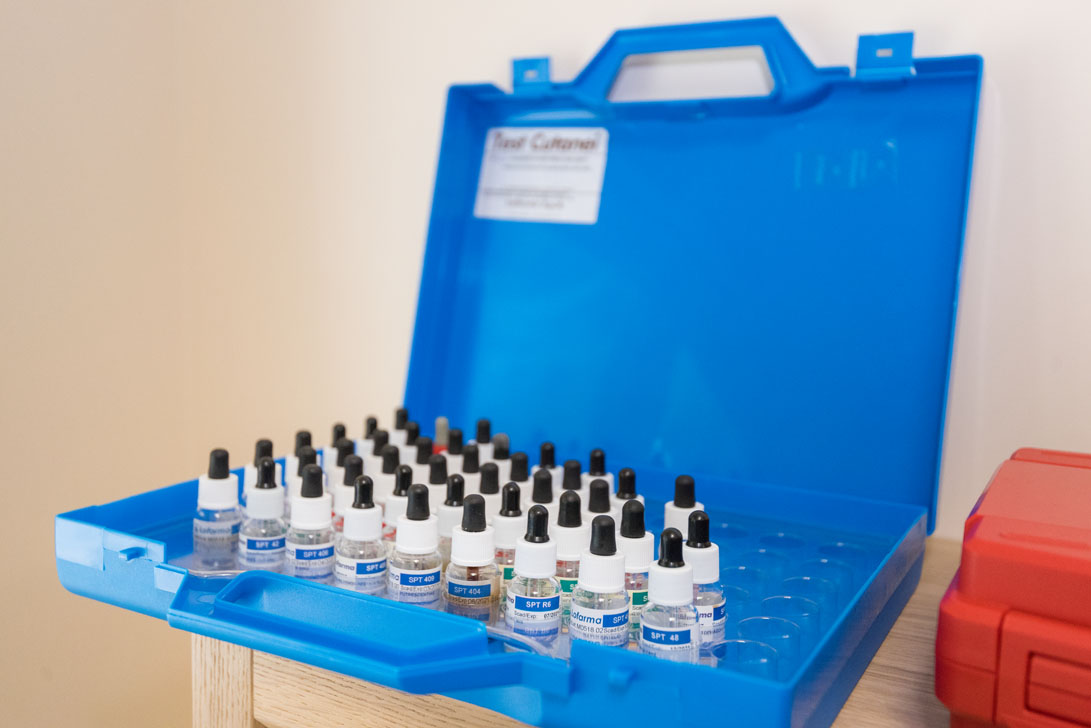 Алергени за изследване